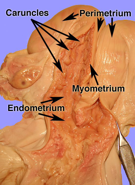cut uterus