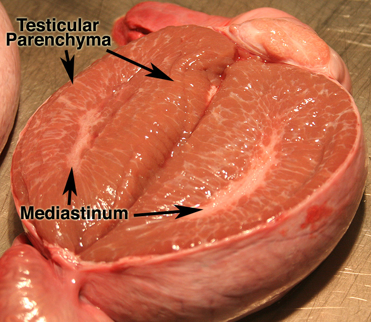 mediastinum