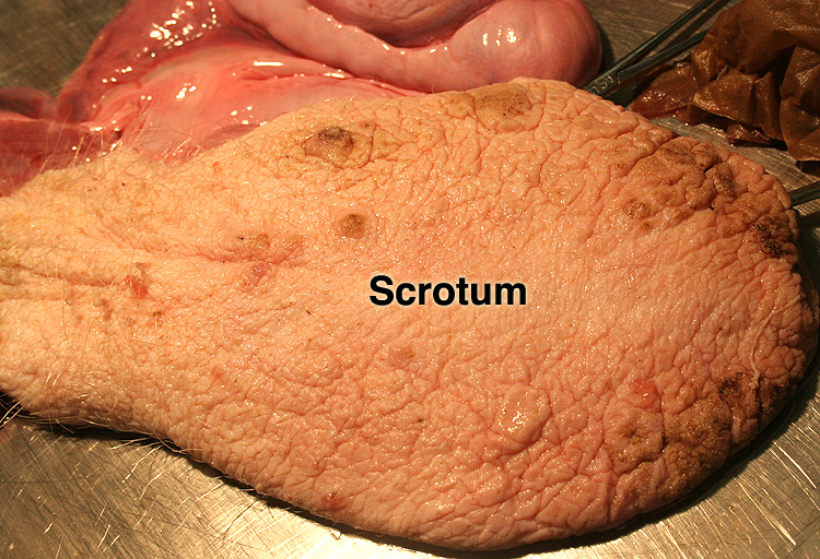 scrotum