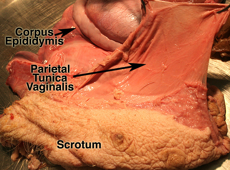 tunica vaginalis and scrotum
