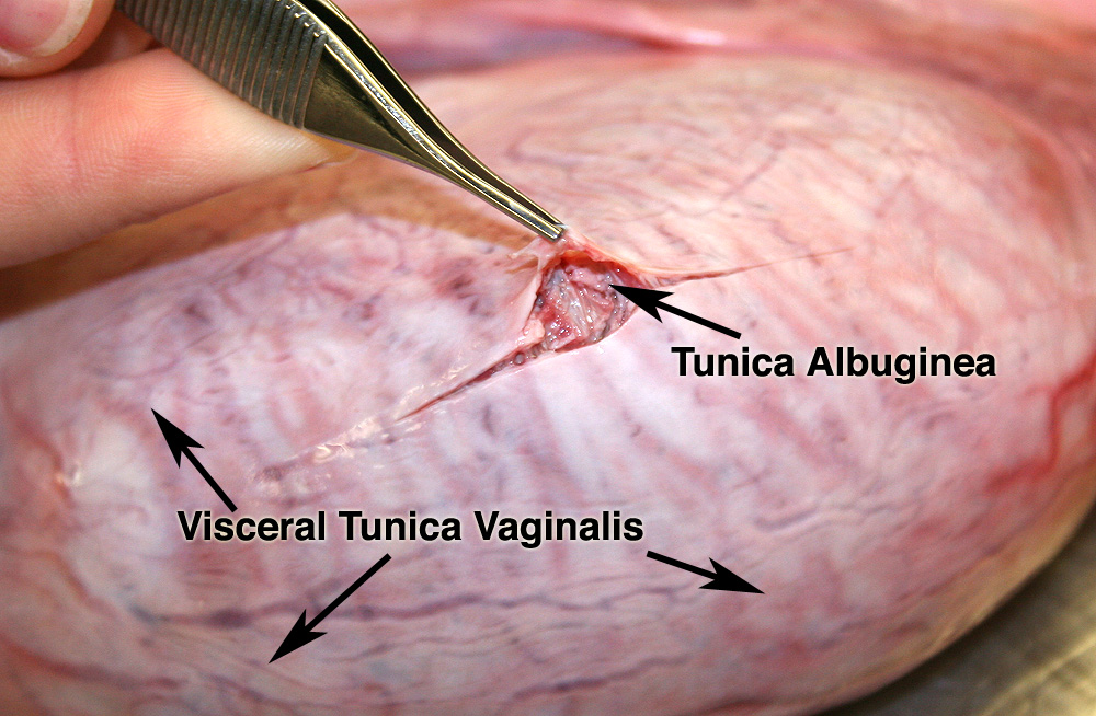 tunica albuginea on testis