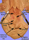 cervix