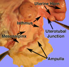 oviduct