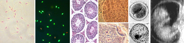 photos of how  sperm and oocytes combine to make an embryo and fetus