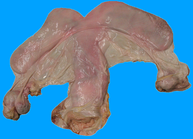 uterus