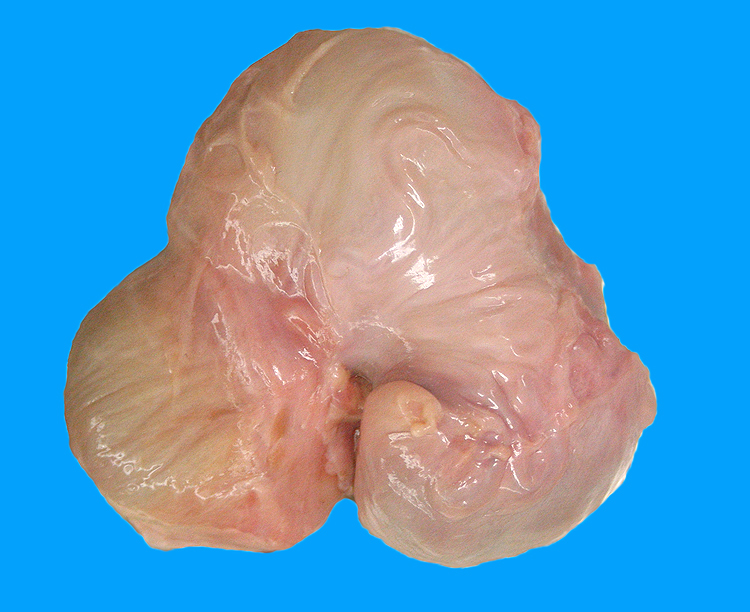 ovary