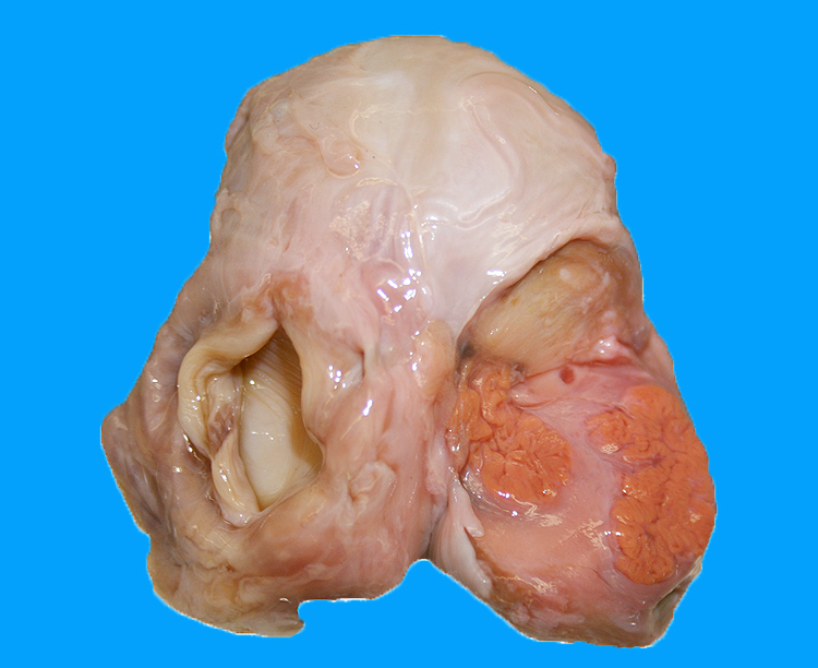 ovary