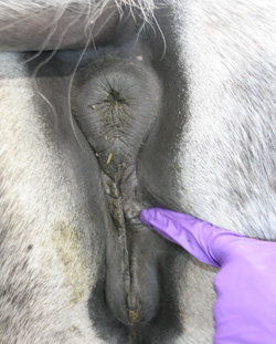 vulva 75% below pelvis
