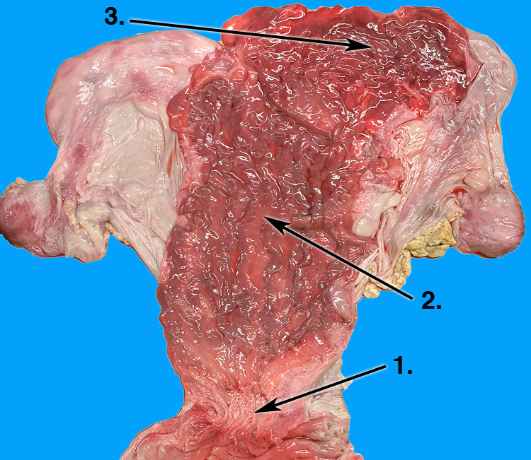 uterus