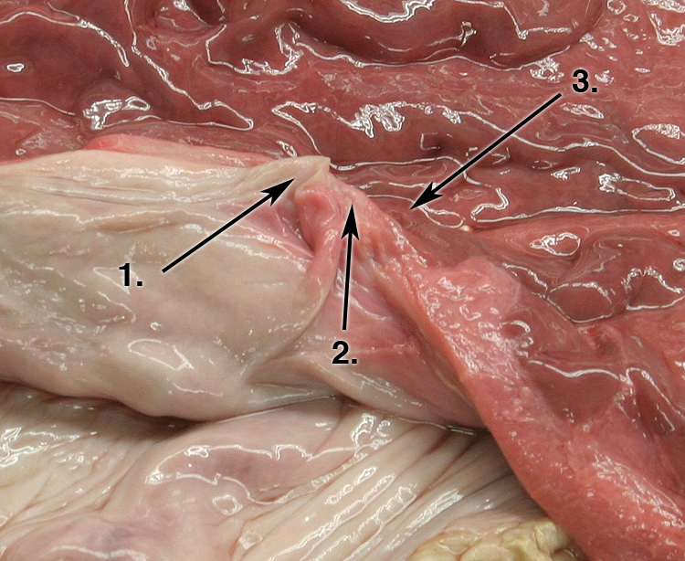 uterus