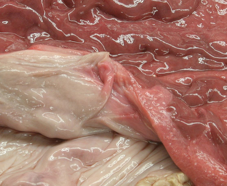 uterus