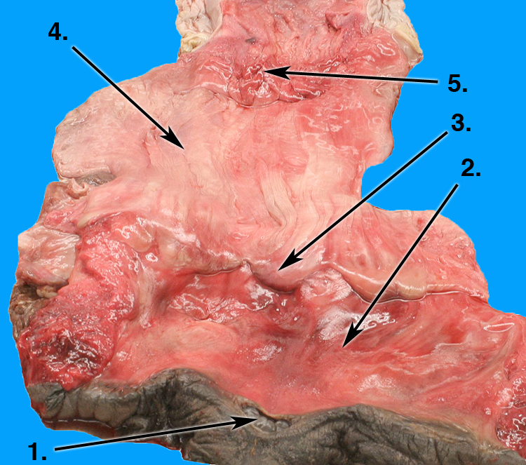 posterior vagina