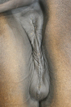 normal vulva