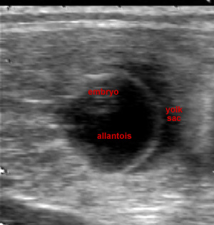 ultrasound image of vesicle with embryo and allantois and yolk sac