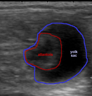 ultrasound image with allantois and larger yolk sac