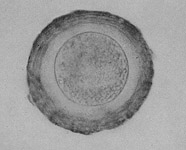 parascaris equorum