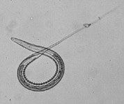 Strongyles equii larva