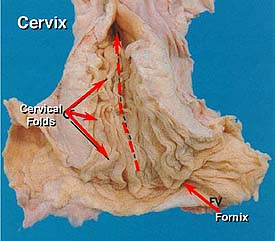photo of the mare cervix shoewing longitudinal folds