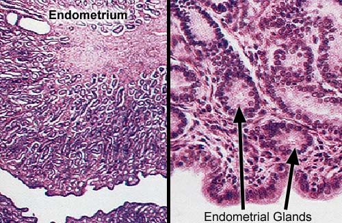 histological pictures of the uterine endometrium with a close up of endometrial glands