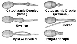 diagram of midpiece abnormalities