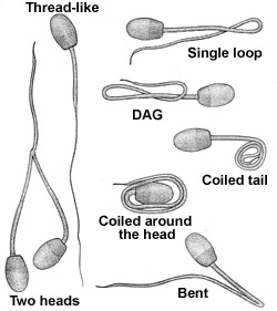 diagrams of tail abnormalities