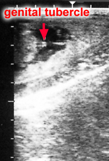 ultrasound image of male fetus