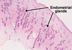 normal estrual uterus cytology